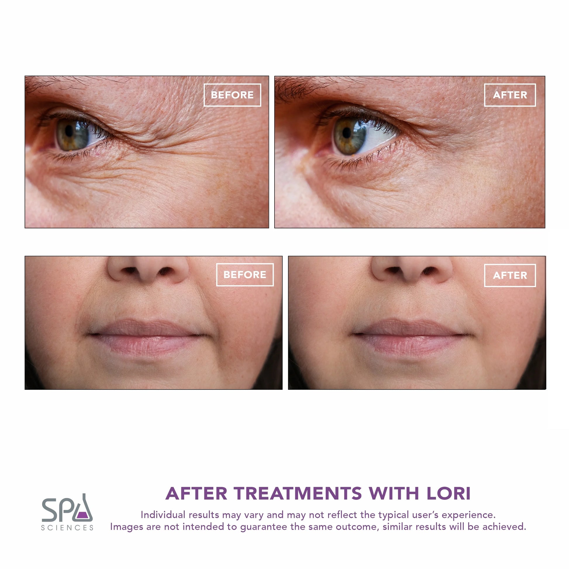 LORI: Facial Lifting & Serum Infusion Wand with Cold & Heat Therapy for Eyes & Lips